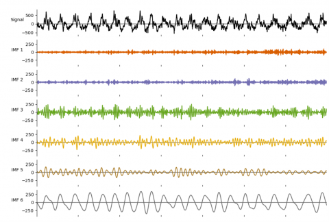 A local field potential plotted and the top in black, and plots of six extracted 'intrinctic mode functions' (IMFs) which are oscillatory, each at a different frequency, with amplitude for each changing throughout the plotted period. The bottom plot, IMF 6, theta, is a large and fairly constant amplitude.