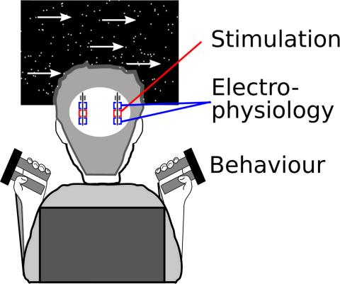 diagram of the back of a participant in the study, showing the stimulus display with moving points, and the electrode arrange ment- an electrode in each side of the brain, and two recording sites per electrode, with a stimulating contact in between the two. The participant holds grasping measuring apparatus in each hand.