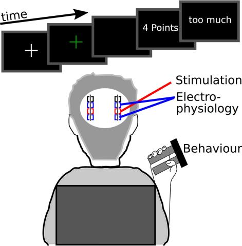 diagram of a person facing away from the viewer, with representation of deep brain electrodes in their head, with and illustatraion of the task's screen bing displayed to them, and a grasp-strength measuring device in their hand 