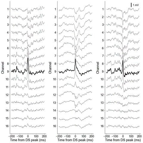 Dentate spike waveforms: Each panel shows the local field potential of each linear probe channel across the dentate gyrus of mouse A during the occurrence of a dentate spike within a 400-ms window around the peak. Dentate spikes are detected from the channel located at the hilus highlighted in black.