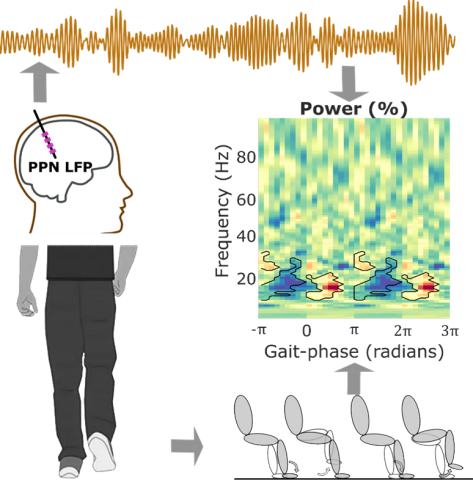 A diagram showing PPN DBS electrode recording, power analysis and gait analysis.