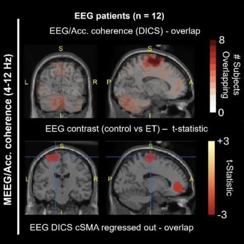 four MRI images