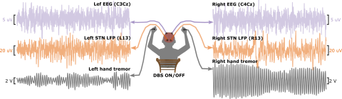 a diagram of a person sat facing away, with plots of electrophyiological traces on either side of them