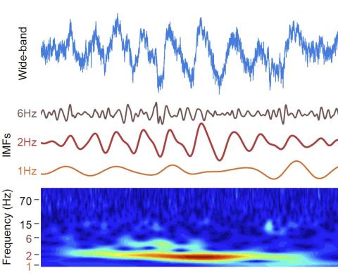 showing wideband lfp, extracted IMFs and power spectra
