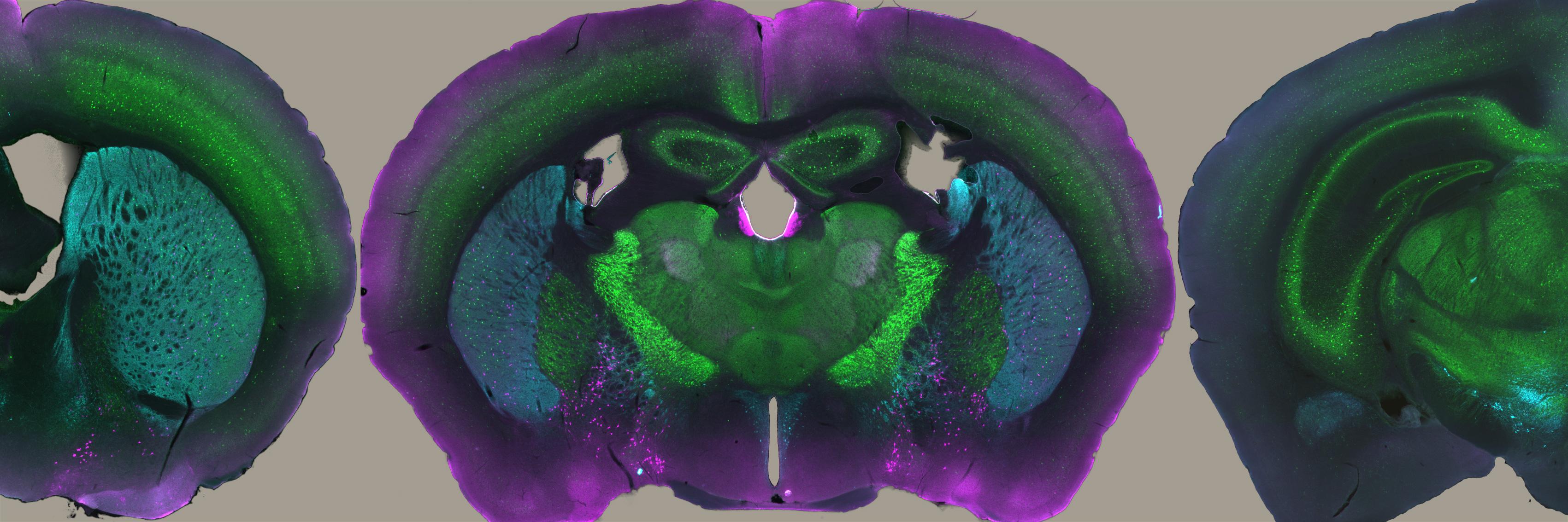 brain sections