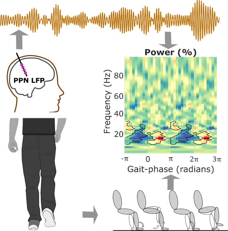 A diagram showing PPN DBS electrode recording, power analysis and gait analysis.