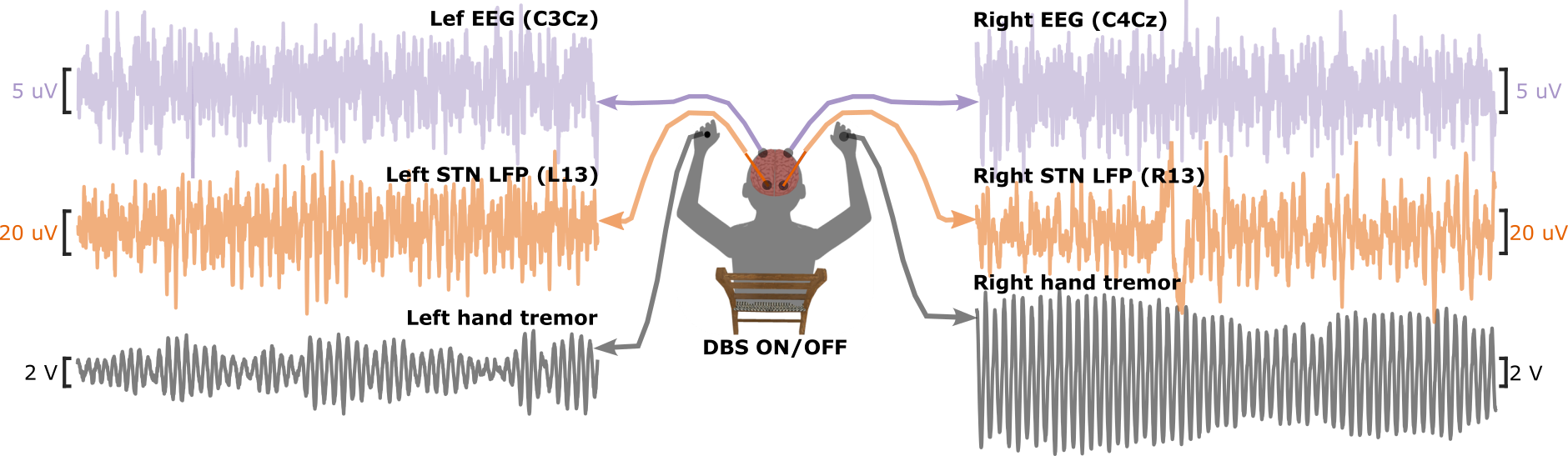 a diagram of a person sat facing away, with plots of electrophyiological traces on either side of them